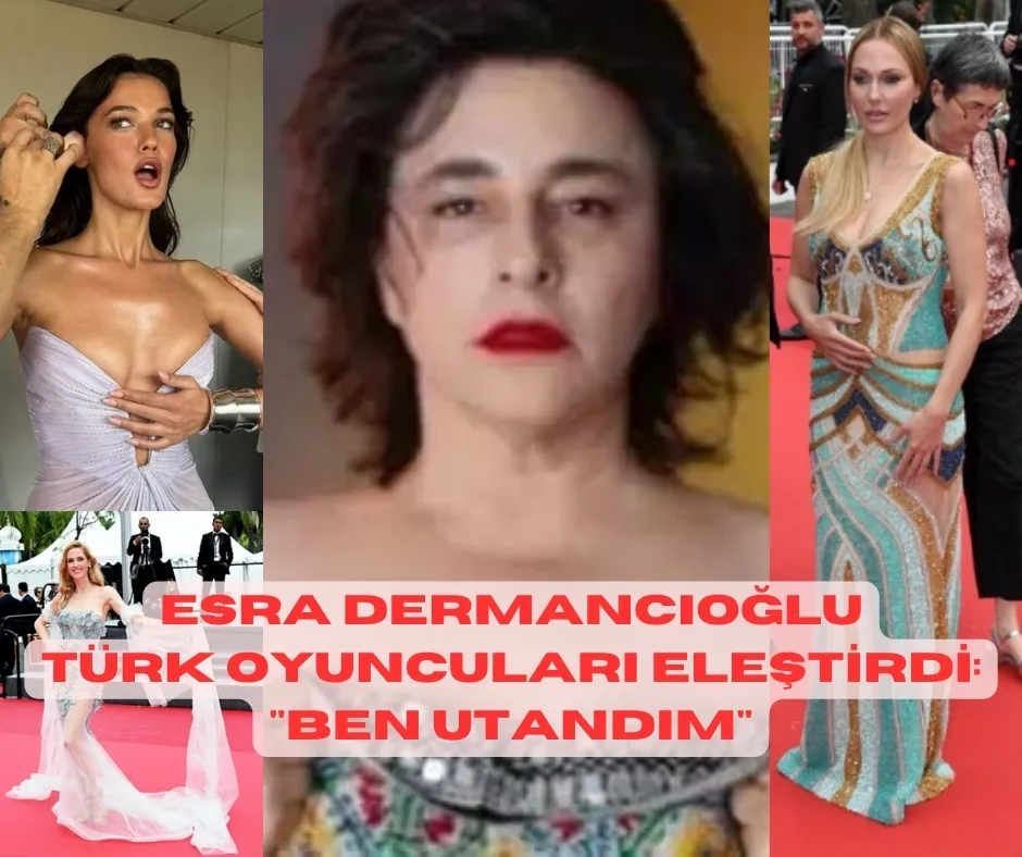 Esra Dermancıoğlu, Türk Oyuncuları Eleştirdi: 